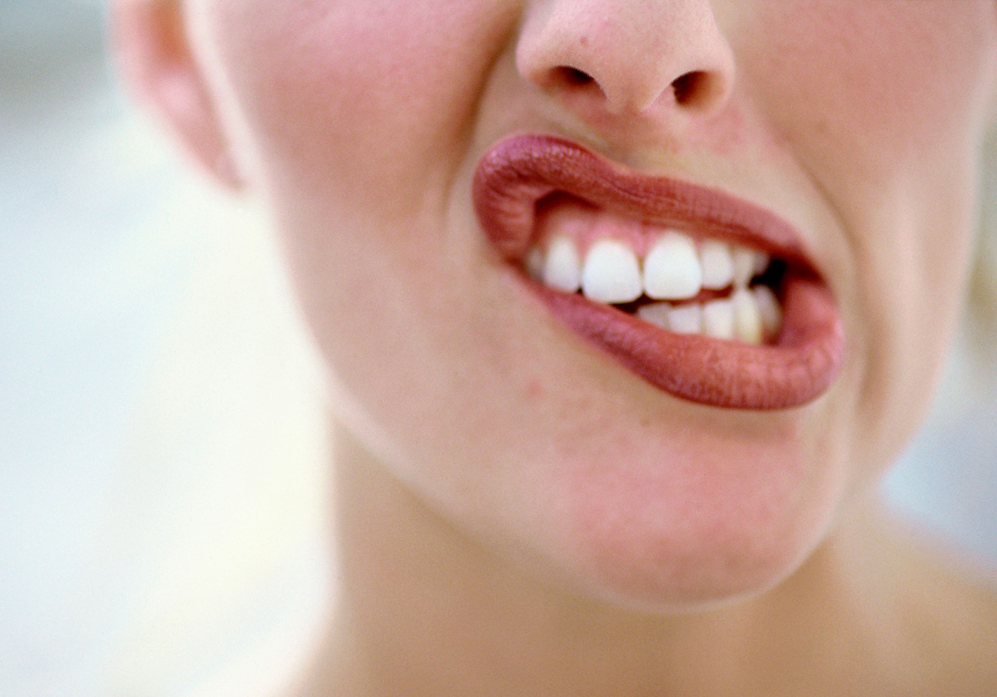 Existe tratamento para afta? Listamos pra você os principais cuidados ...